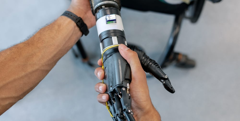 Handslag mellan en person med en konstgjord hand och en med en vanlig hand.