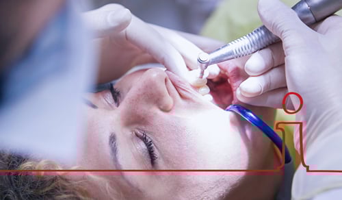 En kvinna som får sina tänder kontrollerade av en tandläkare.